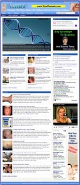 Product picture Eczema Website With Private Label Rights