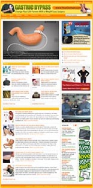 Product picture Gastric Bypass Website - With Private Label Rights